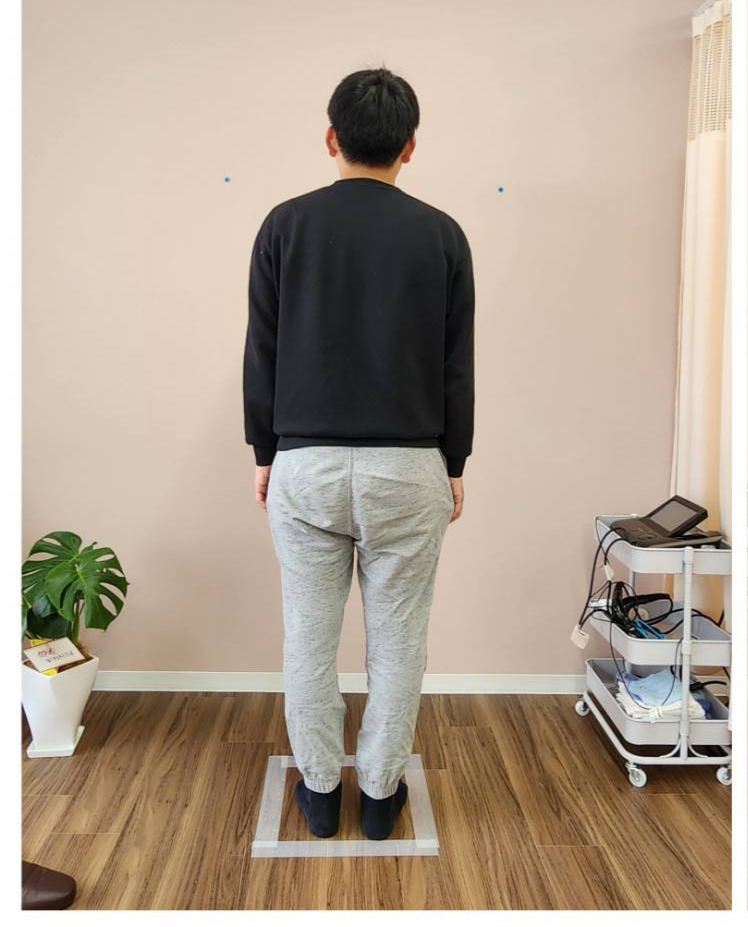 姿勢が傾き、首肩に負担のかかる後ろから_施術前の画像